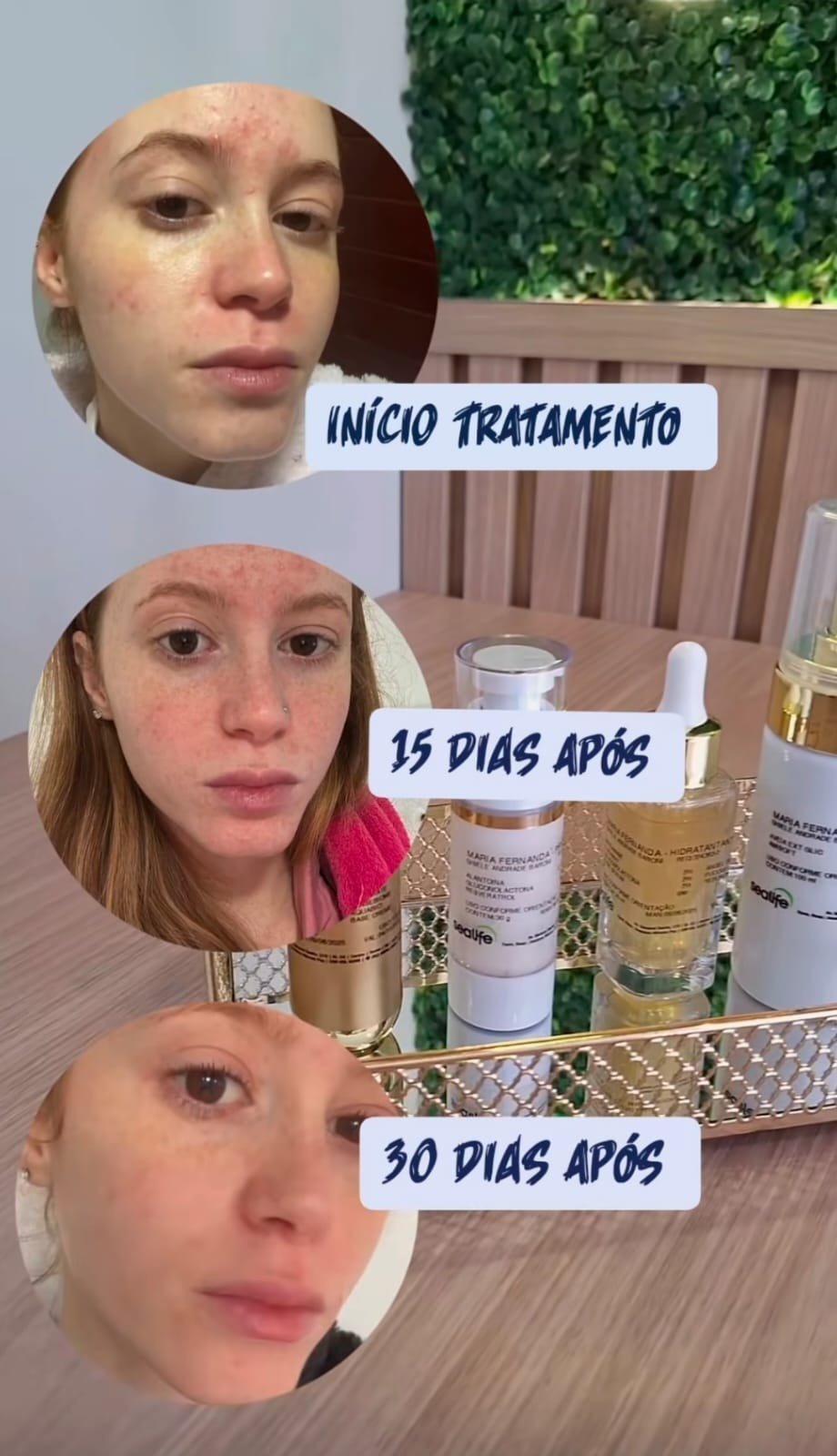 Evolução da pele: início do tratamento, 15 dias e 30 dias após